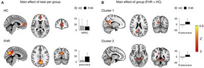 Hyperactivation of Posterior Default Mode Network During Self-Referential Processing in Children at Familial High-Risk for Psychosis